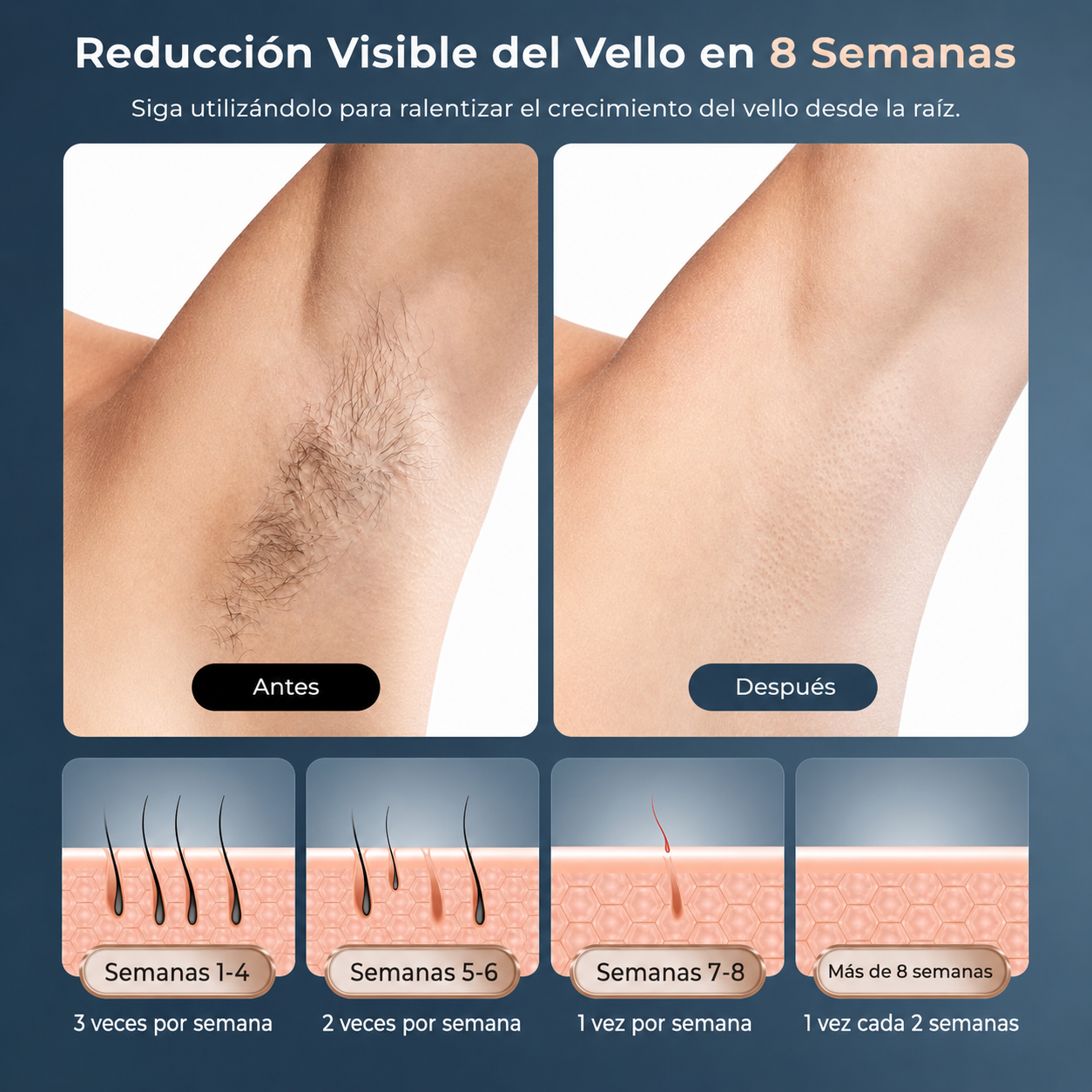 Adiós al Vello y la Irritación Tecnología IPL con efecto frío para ayudarte a conseguir hasta un 99% menos vello desde casa.