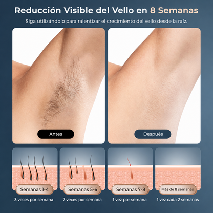 Adiós al Vello y la Irritación Tecnología IPL con efecto frío para ayudarte a conseguir hasta un 99% menos vello desde casa.